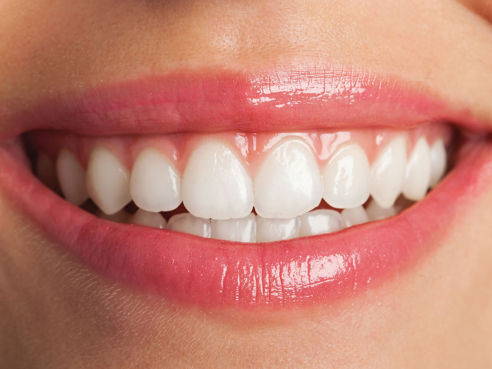 The Truth About Teeth Whitening: Risks And Side Effects